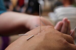 Le logiche legate alla MTC (Medicina Tradizionale Cinese) e ai meridiani hanno corrispondenze nella nostra medicina